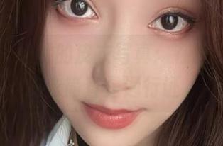 First Image